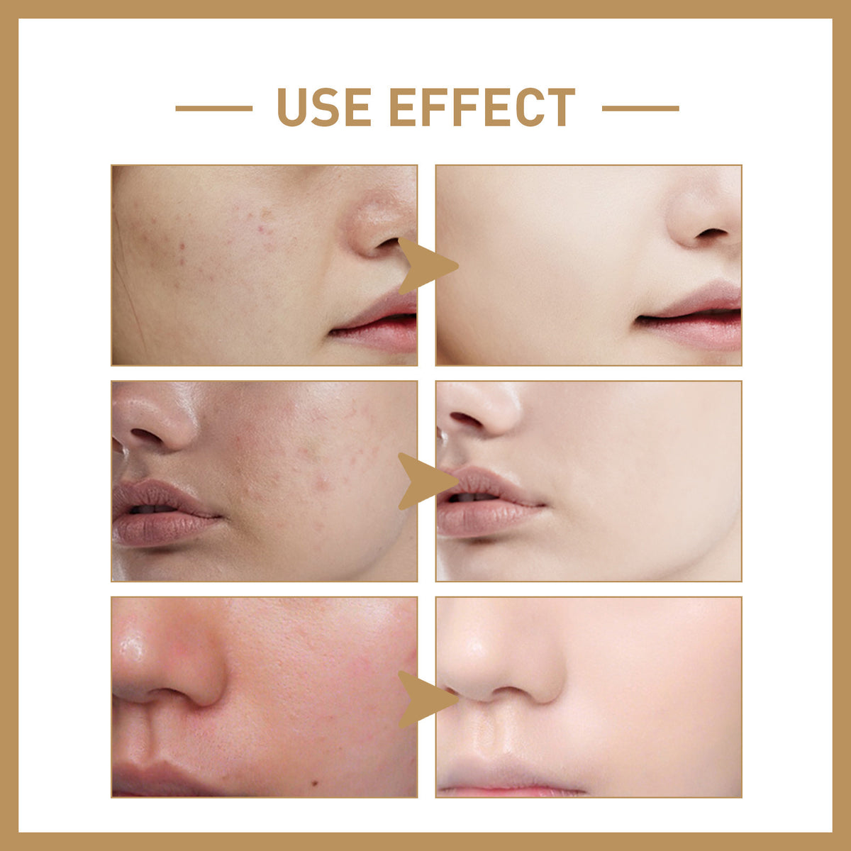 EELHOE Rice Toner Deep Moisturizing Repair Skin Barrier Firming Softening Facial Skin Toner
